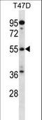ADP Ribosylation Factor GTPase Activating Protein 3 antibody, LS-C156455, Lifespan Biosciences, Western Blot image 