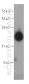 DIRAS Family GTPase 2 antibody, 15557-1-AP, Proteintech Group, Western Blot image 