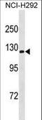 ATPase Na+/K+ Transporting Subunit Alpha 3 antibody, LS-C157563, Lifespan Biosciences, Western Blot image 
