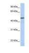 CGRP type 1 receptor antibody, NBP1-59073, Novus Biologicals, Western Blot image 