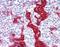 Keratin 10 antibody, orb95711, Biorbyt, Immunohistochemistry paraffin image 