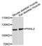 Piwi Like RNA-Mediated Gene Silencing 2 antibody, abx135740, Abbexa, Western Blot image 