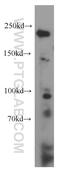 Dicer 1, Ribonuclease III antibody, 20567-1-AP, Proteintech Group, Western Blot image 