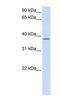 Chromosome 21 Open Reading Frame 91 antibody, NBP1-56401, Novus Biologicals, Western Blot image 