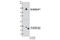 Cbl Proto-Oncogene B antibody, 9498S, Cell Signaling Technology, Western Blot image 