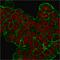 ERBB2 antibody, AE00271, Aeonian Biotech, Immunohistochemistry frozen image 