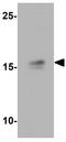 Ninjurin 1 antibody, GTX31596, GeneTex, Western Blot image 