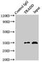 TNFRSF1A Associated Via Death Domain antibody, orb51626, Biorbyt, Immunoprecipitation image 