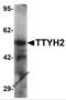 Tweety Family Member 2 antibody, 6885, ProSci, Western Blot image 