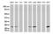 O-6-Methylguanine-DNA Methyltransferase antibody, LS-C796820, Lifespan Biosciences, Western Blot image 