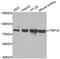 Transient Receptor Potential Cation Channel Subfamily V Member 5 antibody, STJ28556, St John