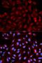 Proteasome Activator Subunit 3 antibody, LS-C330887, Lifespan Biosciences, Immunofluorescence image 