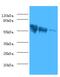 Rabies virus Glycoprotein G antibody, abx110622, Abbexa, Western Blot image 