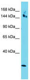 Coiled-Coil Domain Containing 141 antibody, TA334850, Origene, Western Blot image 