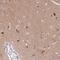 Syntaxin 6 antibody, HPA038558, Atlas Antibodies, Immunohistochemistry paraffin image 