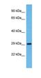 Olfactory Receptor Family 5 Subfamily H Member 14 antibody, orb327057, Biorbyt, Western Blot image 