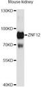 Zinc Finger Protein 12 antibody, LS-C748812, Lifespan Biosciences, Western Blot image 
