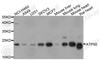 ATP Synthase Peripheral Stalk Subunit OSCP antibody, A8103, ABclonal Technology, Western Blot image 