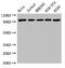 Discoidin Domain Receptor Tyrosine Kinase 2 antibody, CSB-PA620985LA01HU, Cusabio, Western Blot image 