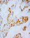 CD49D antibody, LS-C171763, Lifespan Biosciences, Immunohistochemistry frozen image 