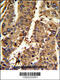 Proteasome Activator Subunit 2 antibody, 62-405, ProSci, Immunohistochemistry paraffin image 