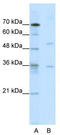 Death Inducer-Obliterator 1 antibody, TA337933, Origene, Western Blot image 