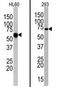 Toll-like receptor 6 antibody, AP11537PU-N, Origene, Western Blot image 