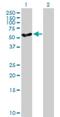 Cytochrome P450 Family 27 Subfamily A Member 1 antibody, H00001593-B01P, Novus Biologicals, Western Blot image 
