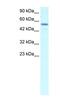 EBF Transcription Factor 3 antibody, NBP1-79982, Novus Biologicals, Western Blot image 