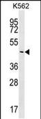 Phosphatidylinositol Specific Phospholipase C X Domain Containing 2 antibody, PA5-48349, Invitrogen Antibodies, Western Blot image 