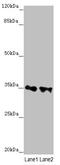 Retinol Dehydrogenase 11 antibody, A55323-100, Epigentek, Western Blot image 