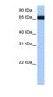 Heterogeneous Nuclear Ribonucleoprotein L Like antibody, NBP1-57407, Novus Biologicals, Western Blot image 