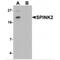 Serine Peptidase Inhibitor, Kazal Type 2 antibody, MBS151088, MyBioSource, Western Blot image 