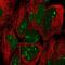 Trophinin antibody, NBP2-58739, Novus Biologicals, Immunocytochemistry image 
