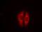 p53 antibody, 79-448, ProSci, Immunofluorescence image 