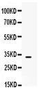 Zinc finger protein SNAI3 antibody, PB9440, Boster Biological Technology, Western Blot image 