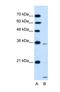 Solute Carrier Family 25 Member 39 antibody, NBP1-59600, Novus Biologicals, Western Blot image 