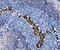 CD38 Molecule antibody, A00193-3, Boster Biological Technology, Immunohistochemistry paraffin image 