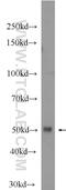 Interferon Regulatory Factor 8 antibody, 24437-1-AP, Proteintech Group, Western Blot image 