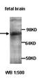 Amyloid Beta Precursor Protein Binding Family A Member 1 antibody, orb77101, Biorbyt, Western Blot image 