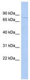 DExH-Box Helicase 58 antibody, TA341623, Origene, Western Blot image 