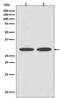 Voltage Dependent Anion Channel 1 antibody, M01168, Boster Biological Technology, Western Blot image 