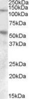 Palladin, Cytoskeletal Associated Protein antibody, PA5-19054, Invitrogen Antibodies, Western Blot image 