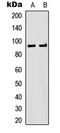 Ribosomal Protein S6 Kinase A5 antibody, LS-C368625, Lifespan Biosciences, Western Blot image 