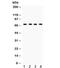 G Protein-Coupled Receptor Kinase 5 antibody, R32073, NSJ Bioreagents, Western Blot image 