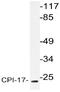 Protein Phosphatase 1 Regulatory Inhibitor Subunit 14A antibody, AP20739PU-N, Origene, Western Blot image 