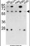 Protein Phosphatase 2 Regulatory Subunit B''Beta antibody, PA5-14873, Invitrogen Antibodies, Western Blot image 