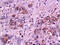 Selectin E antibody, GTX17548, GeneTex, Immunohistochemistry paraffin image 