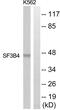 Splicing Factor 3b Subunit 4 antibody, abx014920, Abbexa, Western Blot image 