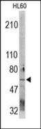 Cell Division Cycle 73 antibody, 200155, Abbiotec, Western Blot image 
